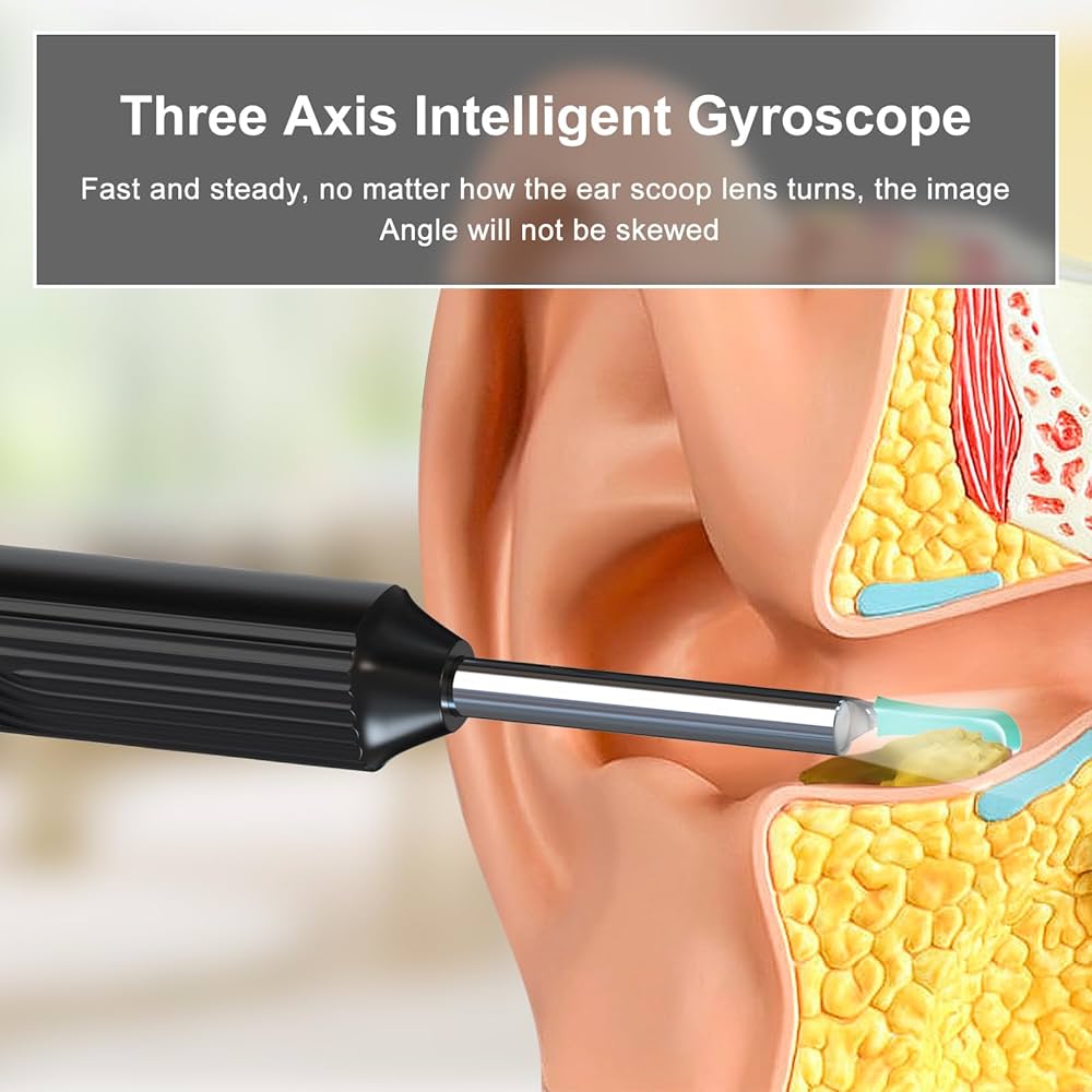 Ear Wax Elimination Kit | Wifi-1080p HD Load Otoscope
