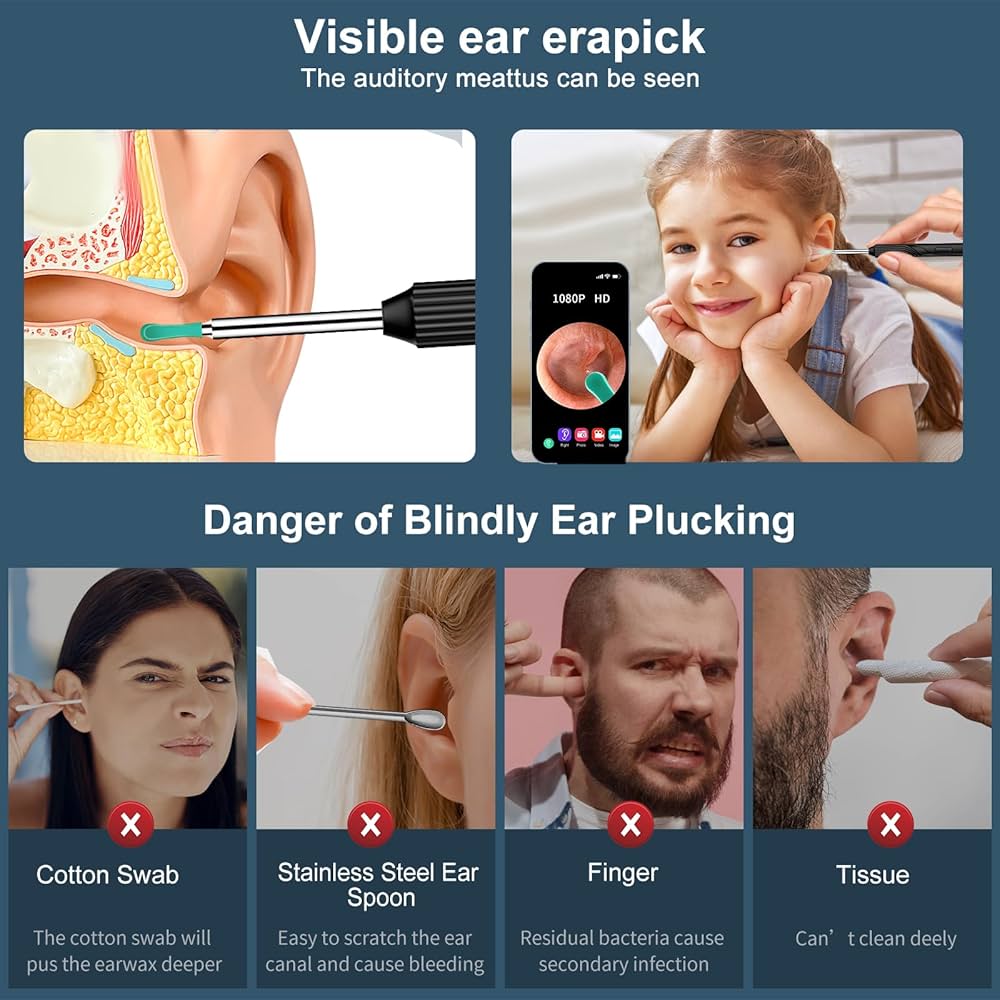 Ear Wax Elimination Kit | Wifi-1080p HD Load Otoscope