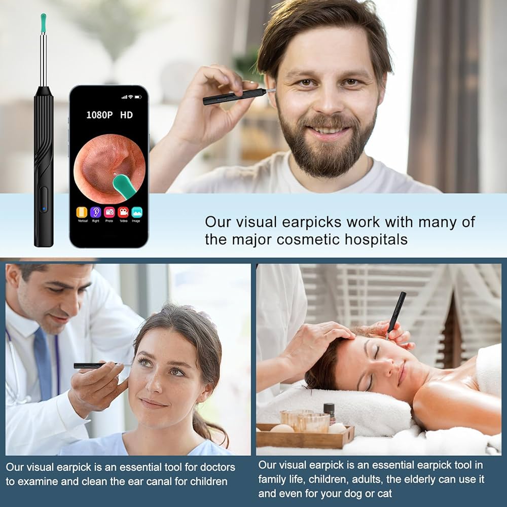Ear Wax Elimination Kit | Wifi-1080p HD Load Otoscope