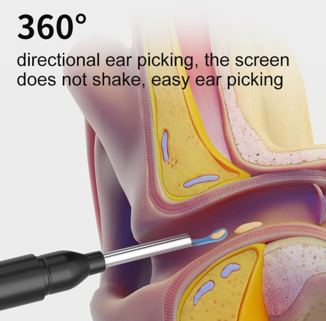 Ear Wax Elimination Kit | Wifi-1080p HD Load Otoscope